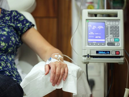 HIPEC (Hyperthermic intraperitoneal chemotherapy)