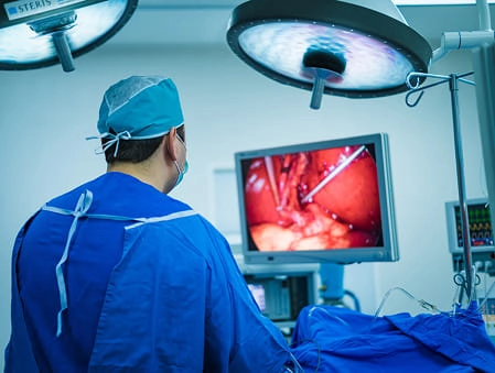 3D Laparoscopy