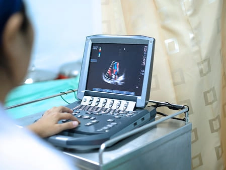 Echocardiography (ECHO)