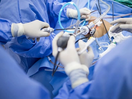 Thyroidectomy