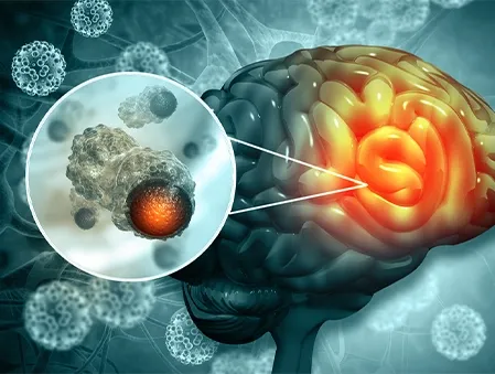 neurointervention-lab