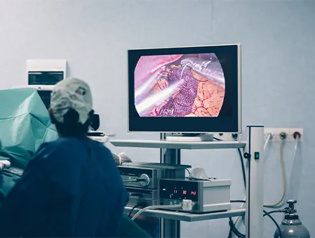 3d-advance-laparoscopic-surgery