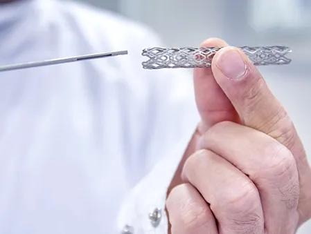 carotid-stenting