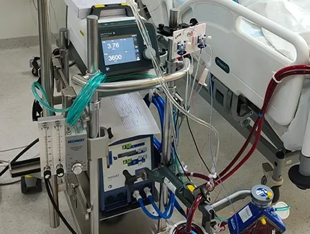 High-Frequency ventilation and ECMO