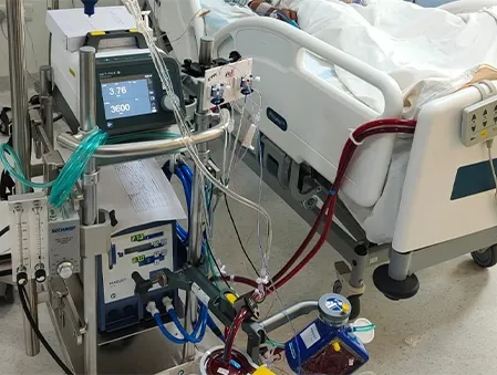 Extracorporeal Membrane Oxygenation