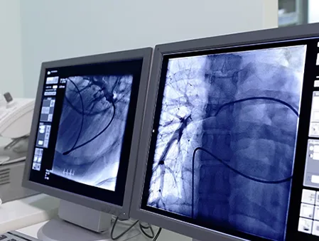Pleural Biopsy