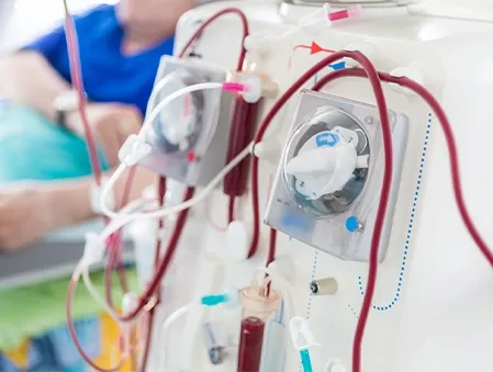Haemodialysis