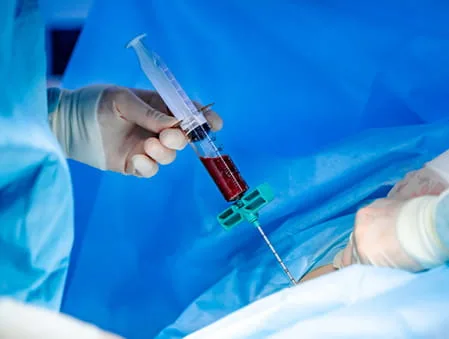 Blood and Bone Marrow Stem Cell Collection