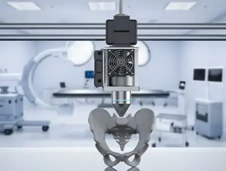 3d-printing-custom-implants