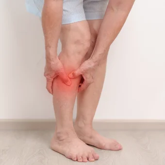 Deep Vein Thrombosis (DVT)