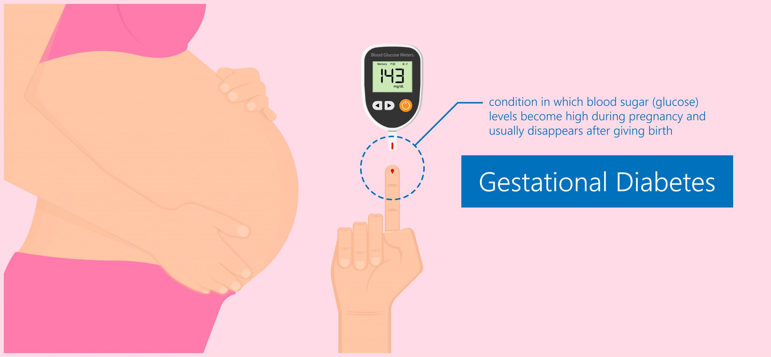 GESTATIONAL DIABETES