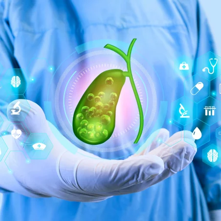 Robotic Cholecystectomy