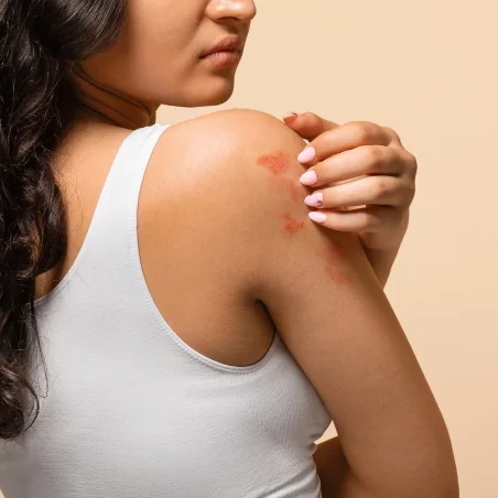 Skin Infections & Allergic Disorders