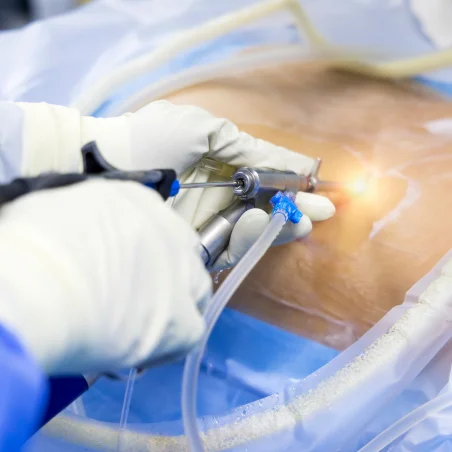 minimally-invasive-endoscopic-spine-surgery