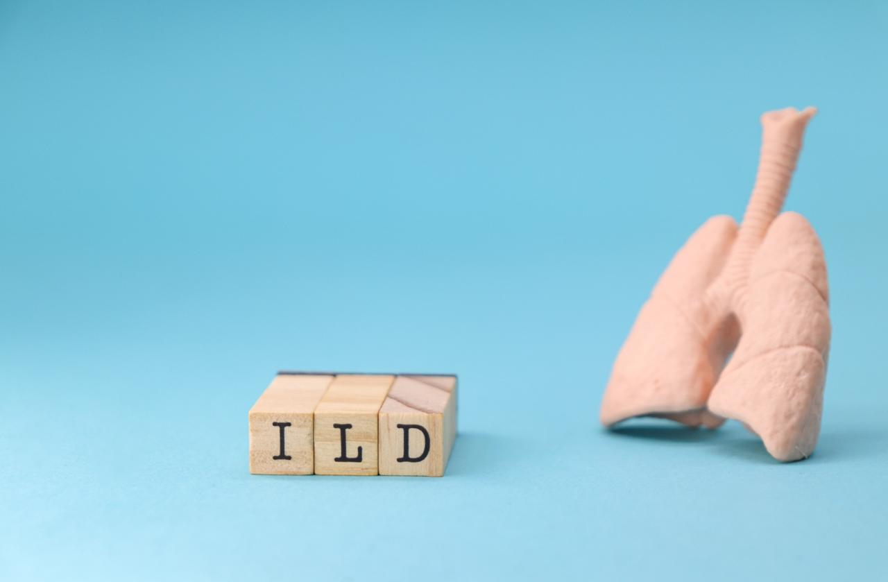 Interstitial Lung Diseases