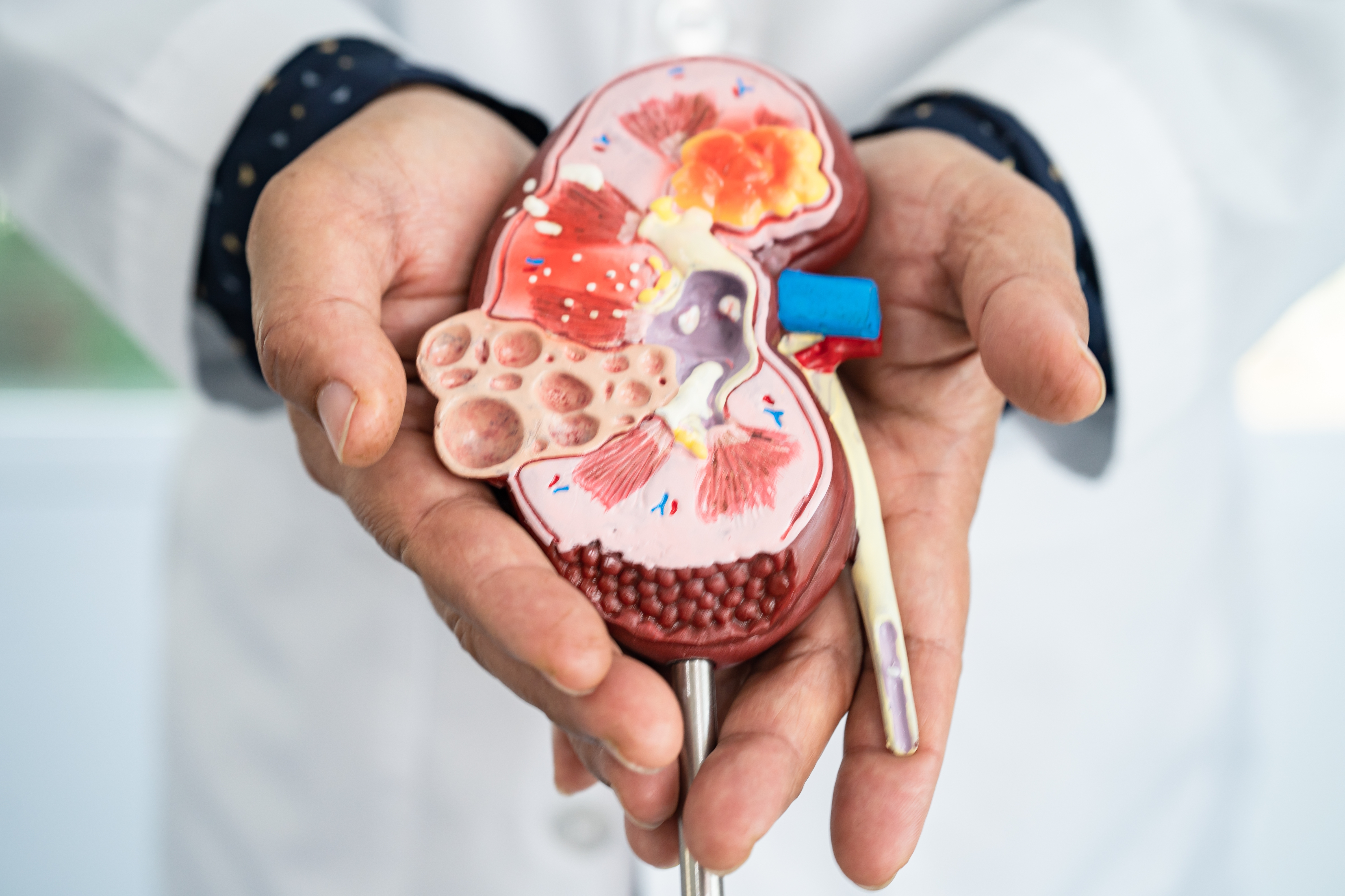 Chronic Kidney Disease (CKD)
