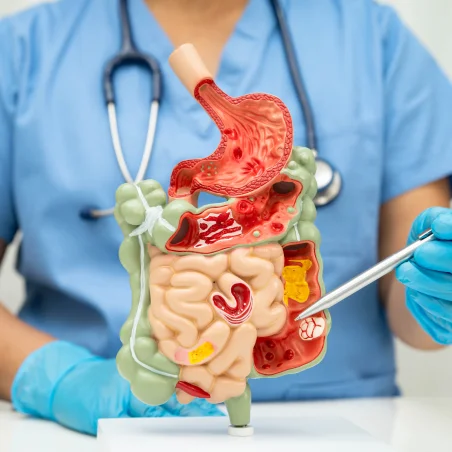 benign-gi-surgical-conditions