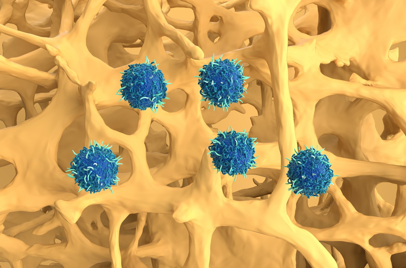CAR-T Cell Therapy