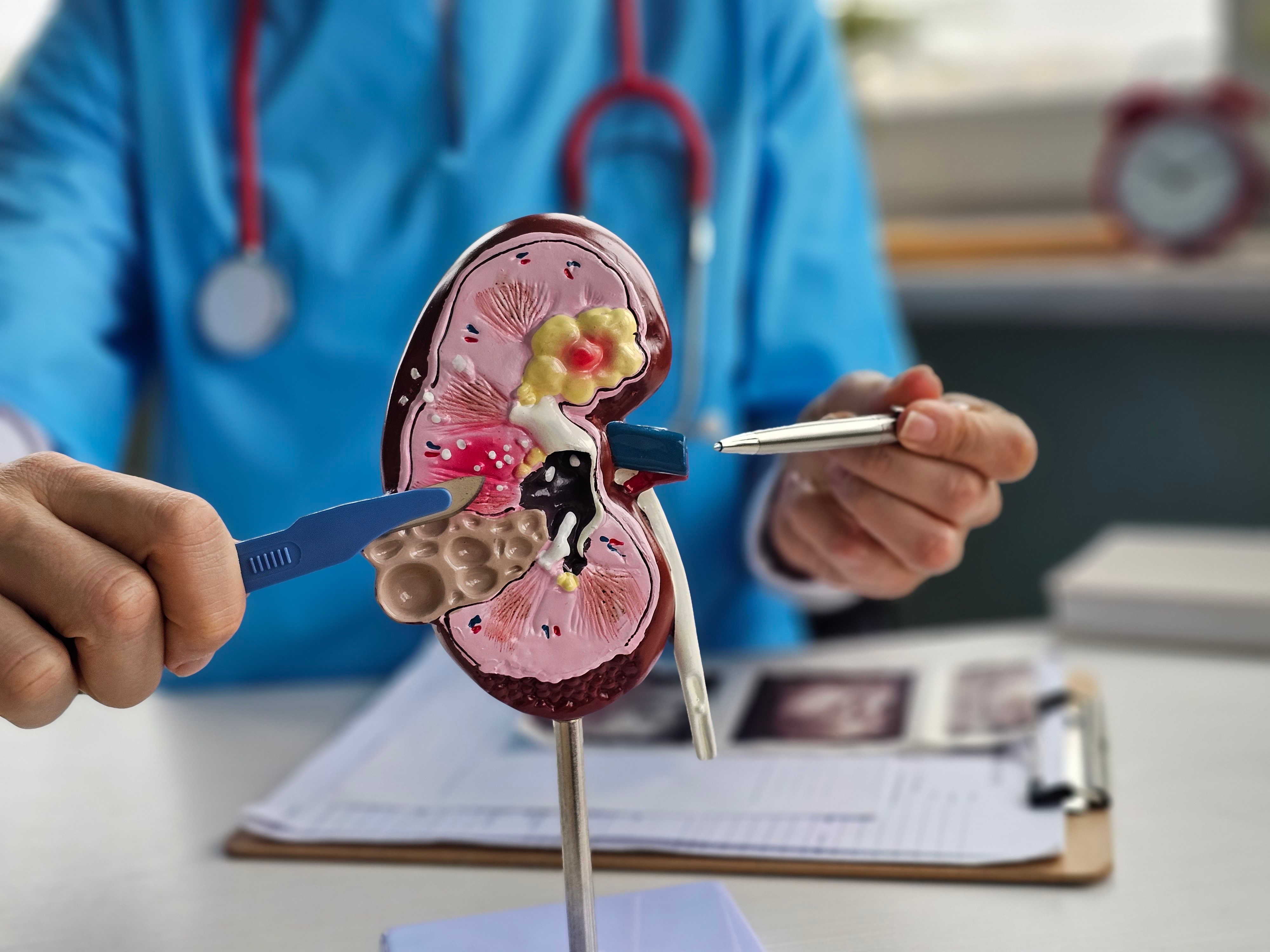 Kidney Transplant Operation
