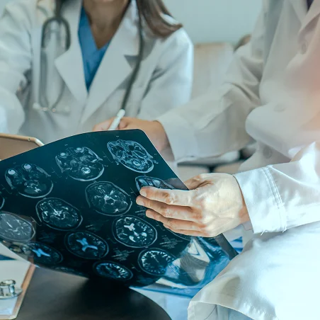 Stroke & Vascular Neurological Disorders