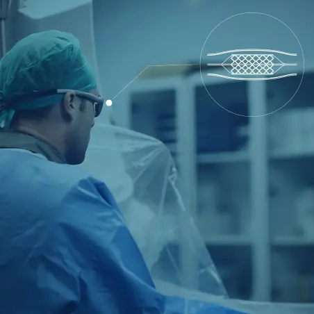 coronary-angioplasty-stent-procedure