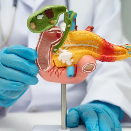 gastrointestinal-hepato-pancreato-biliary-cancers