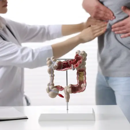 inflammatory-functional-bowel-disorders