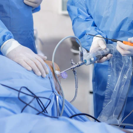 arthroscopic-ligament-repair-eg-acl-reconstruction