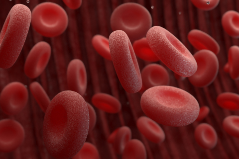 Acute Myeloid Leukemia