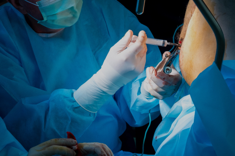 Internal Hemorrhoidal Prolapse