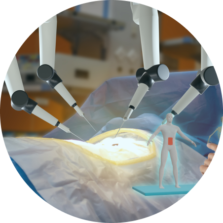 Robotic partial nephrectomy