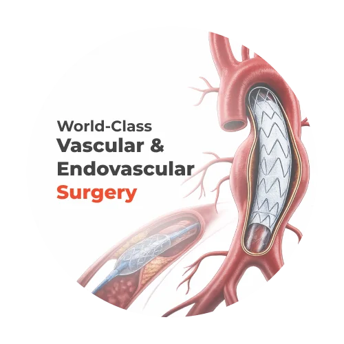 Endovascular