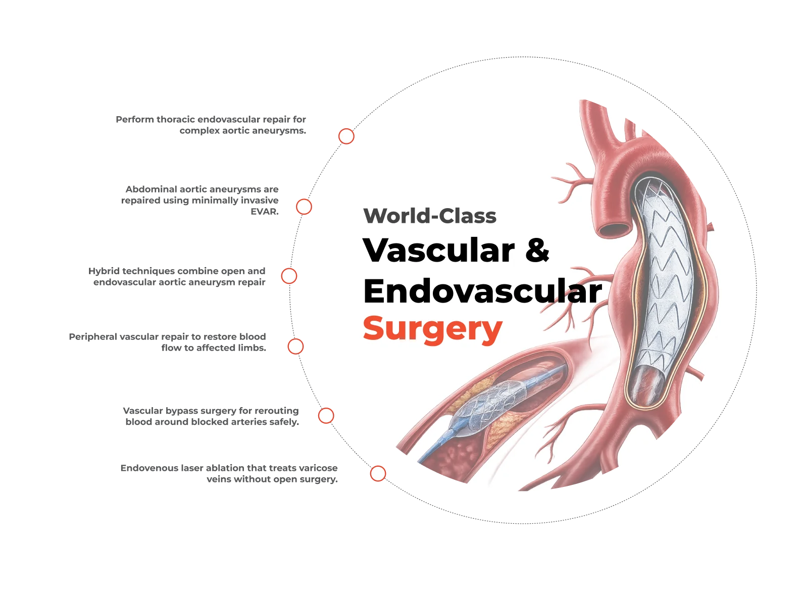 Endovascular