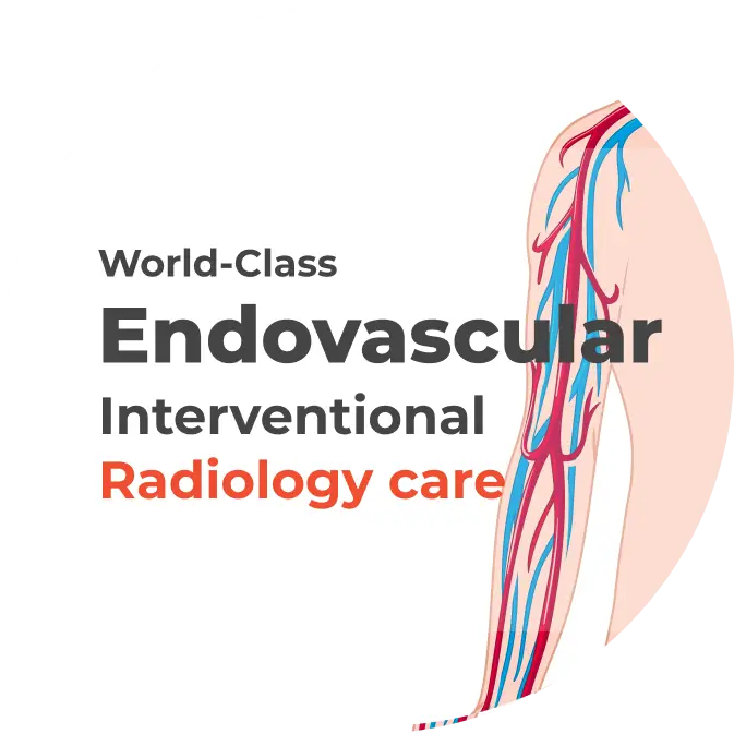 noida-hospital-endovascular-and-interventional-radiology