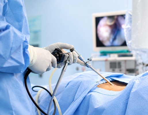 Video Assisted Thoracic Surgery (VATS)