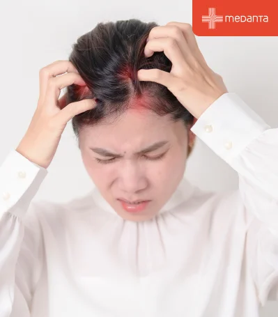 Scalp Fungal Infection