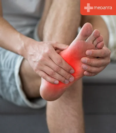 What Is Flat Foot? Causes, Signs, Stages and Treatment Explained