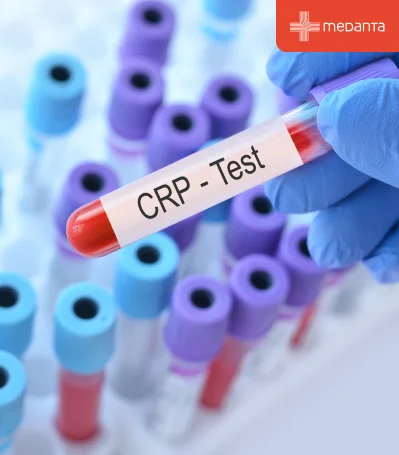 C-Reactive Protein (CRP) Test Purpose, Results & High Levels