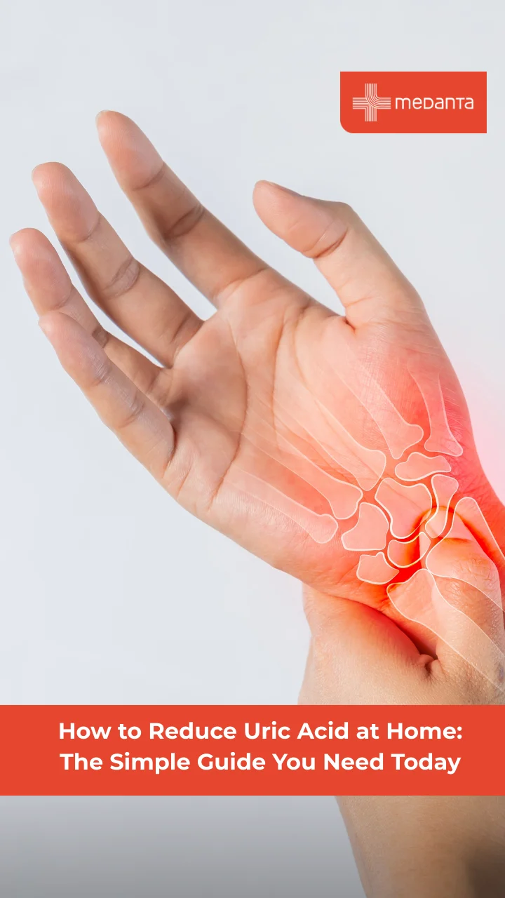 how-to-reduce-uric-acid-at-home