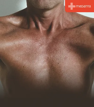 struggling-with-chest-fat-try-these-proven-tips