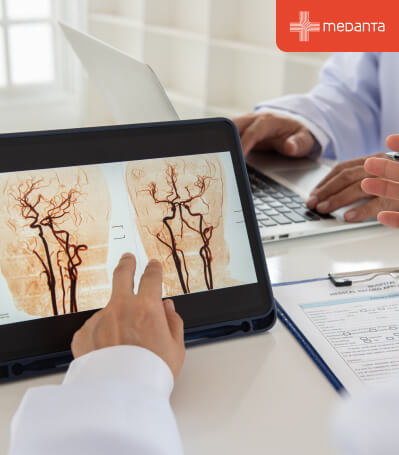 Silent Causes of Brain Aneurysm