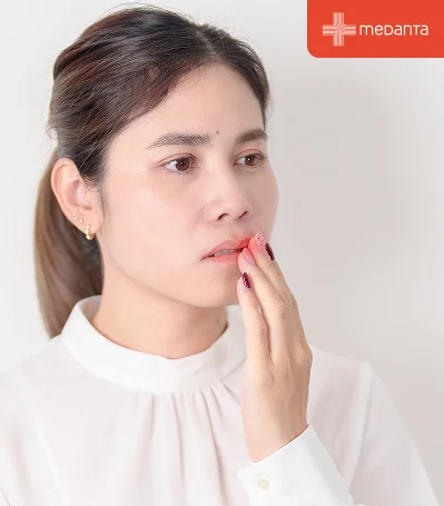 Types of Mouth Ulcers